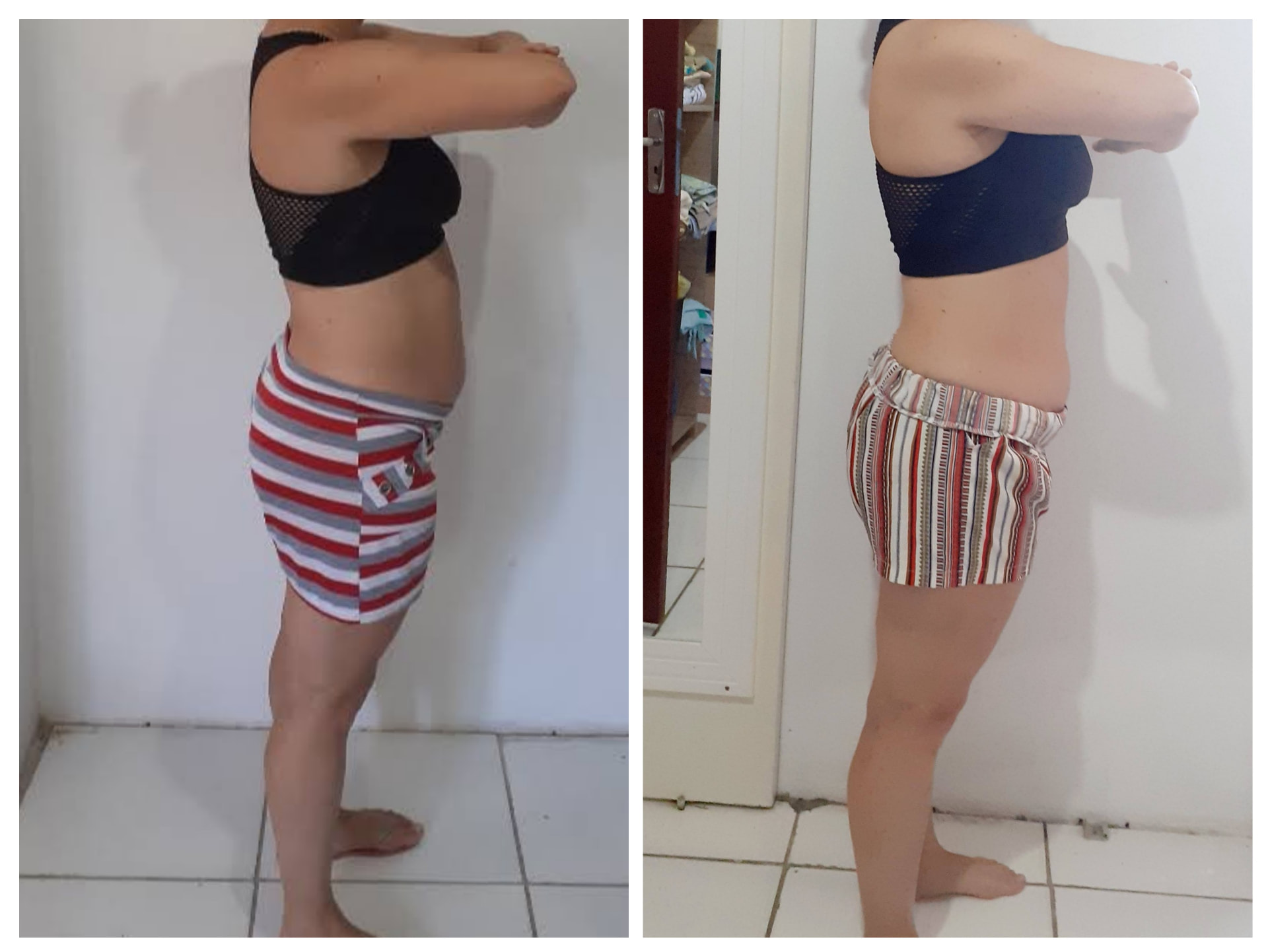 Antes e depois de aluna — vista lateral do abdômen
